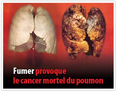 pour tou les fumeurs lisé s'il vou plai pour me faire plaisirs!!!